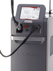 Candela GentleYAG laser hair removal machine